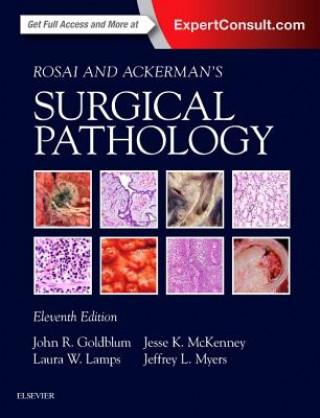 Kniha Rosai and Ackerman's Surgical Pathology - 2 Volume Set Goldblum