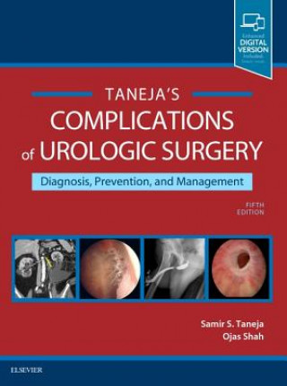 Könyv Complications of Urologic Surgery Samir S. Taneja