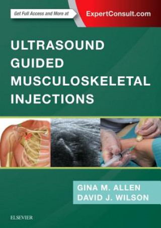 Książka Ultrasound Guided Musculoskeletal Injections Gina M. Allen