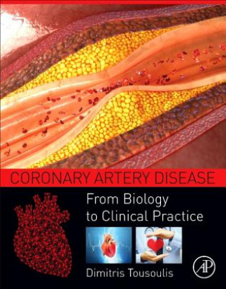 Könyv Coronary Artery Disease Dimitris Tousoulis