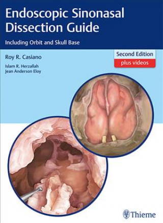 Buch Endoscopic Sinonasal Dissection Guide Roy R. Casiano