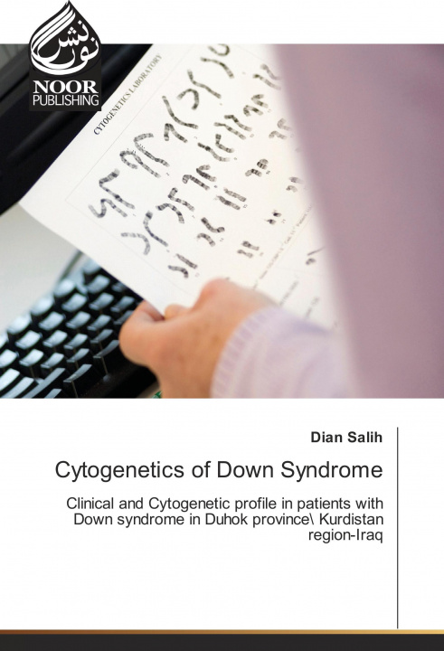 Книга Cytogenetics of Down Syndrome Dian Salih