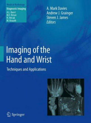 Książka Imaging of the Hand and Wrist A. Mark Davies