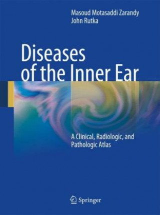 Kniha Diseases of the Inner Ear Masoud Motasaddi Zarandy