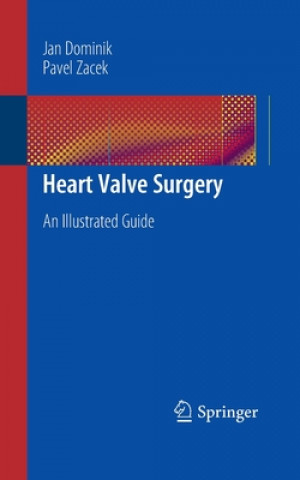 Kniha Heart Valve Surgery Jan Dominik