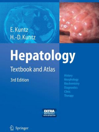 Kniha Hepatology Erwin Kuntz