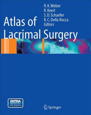 Könyv Atlas of Lacrimal Surgery Rainer Keerl
