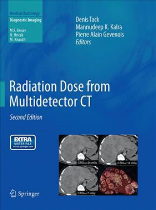 Książka Radiation Dose from Multidetector CT Pierre Alain Gevenois