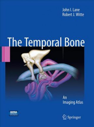 Boek Temporal Bone John I. Lane