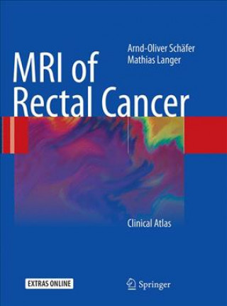 Książka MRI of Rectal Cancer Arnd-Oliver Schafer