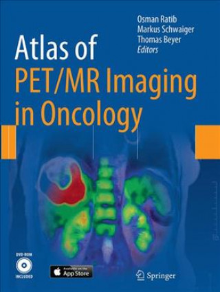Kniha Atlas of PET/MR Imaging in Oncology Osman Ratib