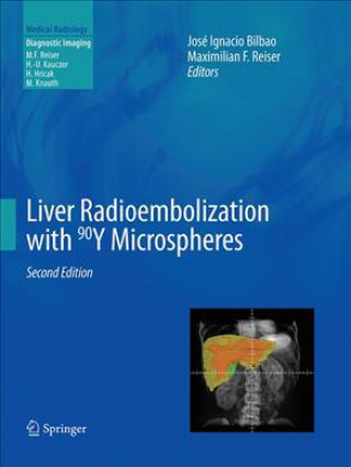 Kniha Liver Radioembolization with 90Y Microspheres José Ignacio Bilbao