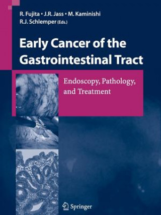 Book Early Cancer of the Gastrointestinal Tract R. Fujita