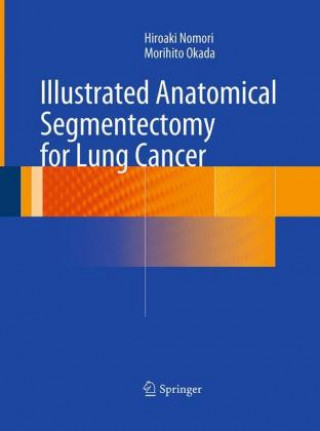 Libro Illustrated Anatomical Segmentectomy for Lung Cancer Hiroaki Nomori