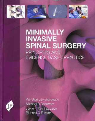 Knjiga Minimally Invasive Spinal Surgery Kai-Uwe Lewandrowski