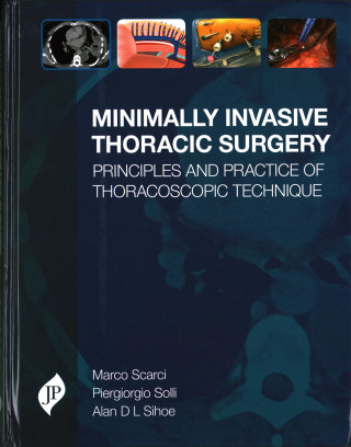 Kniha Minimally Invasive Thoracic Surgery Marco Scarci