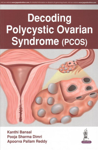 Kniha Decoding Polycystic Ovarian Syndrome Kanthi Bansal