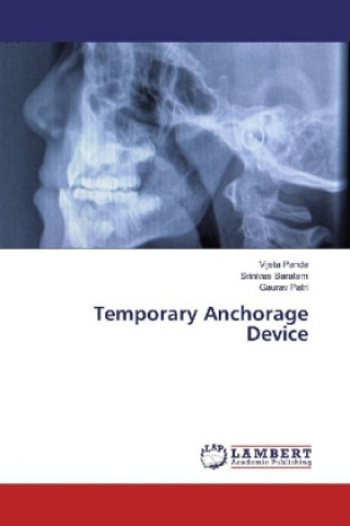 Boek Temporary Anchorage Device Vijeta Panda