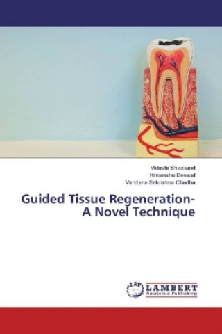 Książka Guided Tissue Regeneration- A Novel Technique Vidushi Sheokand