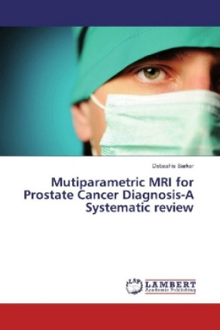 Könyv Mutiparametric MRI for Prostate Cancer Diagnosis-A Systematic review Debashis Sarkar