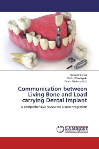 Könyv Communication between Living Bone and Load carrying Dental Implant Swapnil Borkar