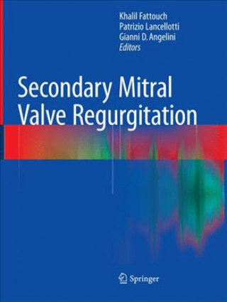 Kniha Secondary Mitral Valve Regurgitation Khalil Fattouch