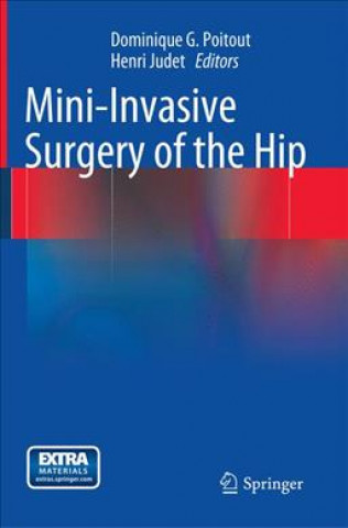 Knjiga Mini-Invasive Surgery of the Hip Dominique G. Poitout