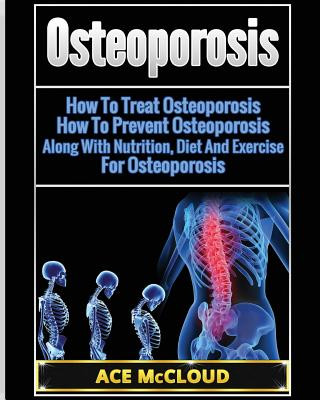 Kniha Osteoporosis Ace McCloud
