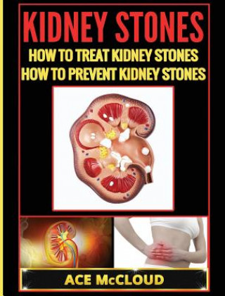Könyv Kidney Stones Ace McCloud