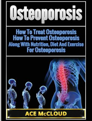 Kniha Osteoporosis Ace McCloud