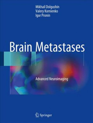 Knjiga Brain Metastases Mikhail Dolgushin
