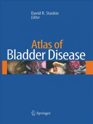 Carte Atlas of Bladder Disease David Staskin