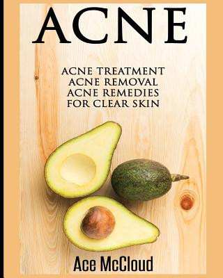 Livre Acne ACE MCCLOUD