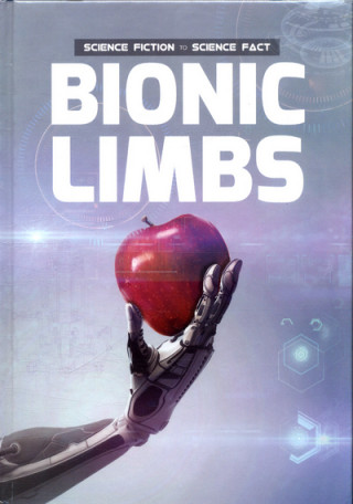 Carte Bionic Limbs Holly Duhig