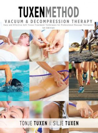 Kniha TuxenMethod Vacuum & Decompression Therapy Tonje Tuxen