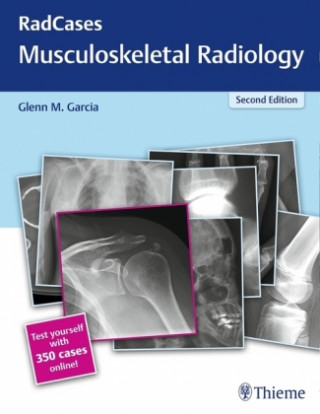 Könyv RadCases Q&A Musculoskeletal Radiology Glenn M. Garcia