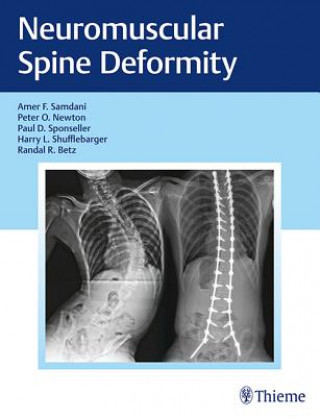 Könyv Neuromuscular Spine Deformity Amer Samdani