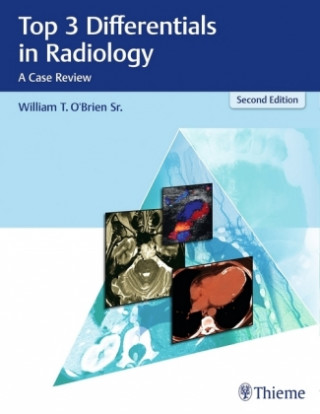 Kniha Top 3 Differentials in Radiology William T. O'Brien