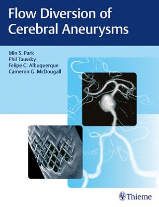 Książka Flow Diversion of Cerebral Aneurysms Min S. Park