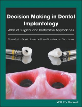 Könyv Decision Making in Dental Implantology - Atlas of Surgical and Restorative Approaches Mauro Tosta