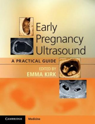 Książka Early Pregnancy Ultrasound Emma Kirk