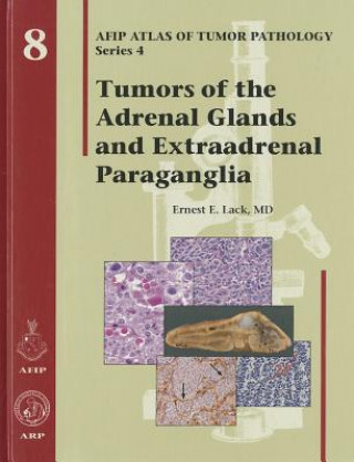 Książka Tumors of the Adrenal Glands and Extraadrenal Paraganglia E. E. Lack