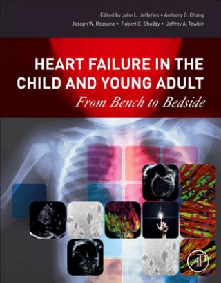 Книга Heart Failure in the Child and Young Adult John Jefferies