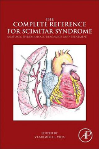 Kniha Complete Reference for Scimitar Syndrome Vladimiro Vida