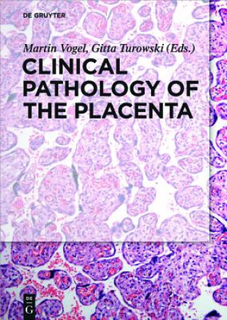 Könyv Clinical Pathology of the Placenta Martin Vogel