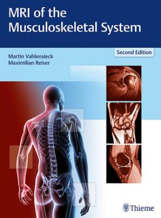 Könyv MRI of the Musculoskeletal System Martin Vahlensieck