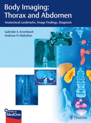 Kniha Body Imaging: Thorax and Abdomen Gabriele A. Krombach