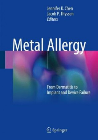 Könyv Metal Allergy Jennifer K Chen