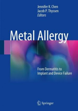 Książka Metal Allergy Jennifer K Chen