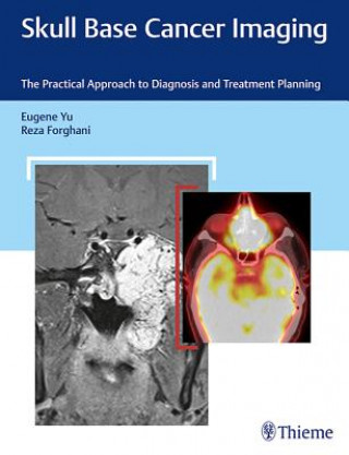 Könyv Skull Base Cancer Imaging Eugene Yu